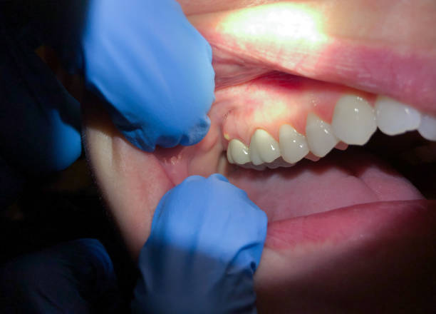 Best Emergency Orthodontic Repairs in Scanlon, MN